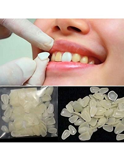 100-Pcs Dental Componeer Thin Whitening Resin Veneer Upper Anterior Front Back Molar Teeth